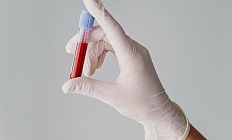 Малый объем пробирок для забора крови снижает количество гемотрансфузий в ОРИТ